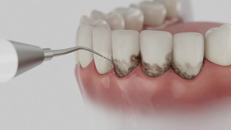 Reliable Dental contractor in Mead, CO by Smile Center Dentistry
